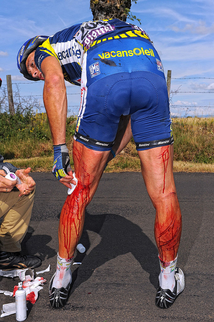 Johnny Hoogerland after crashing into a barbed wire fence at the 2011 Tour de France