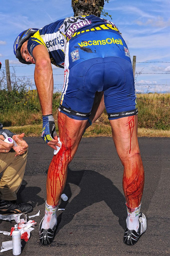 Johnny Hoogerland after crashing into a barbed wire fence at the 2011 Tour de France
